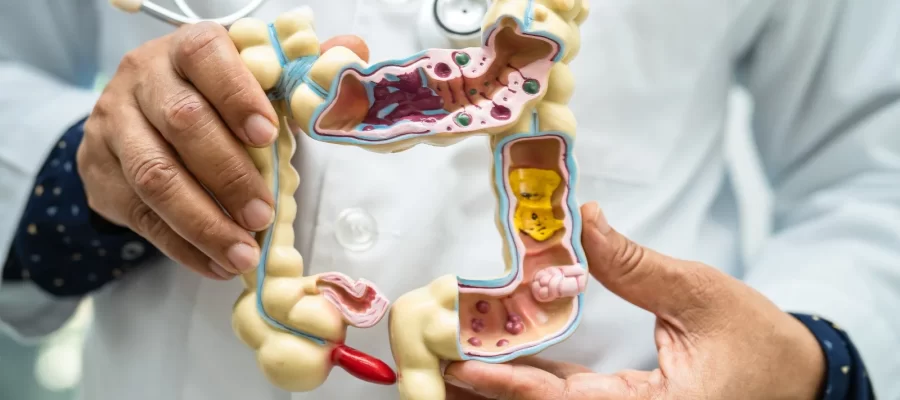 Doença de Crohn - Benefícios do Mamão - AGC